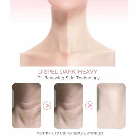 EMS RED LIGHT FACE & NECK LIFT – WRINKLE REMOVER & SKIN TIGHTENER